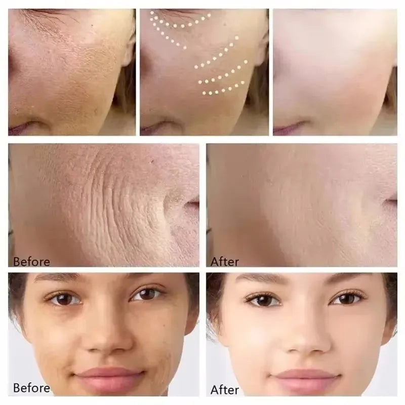 Instant Wrinkle Remover, Firming Facial Serum That Fades Fine Lines, Anti-Aging Essence, Whitens, Brightens, Nourishes Skin Care