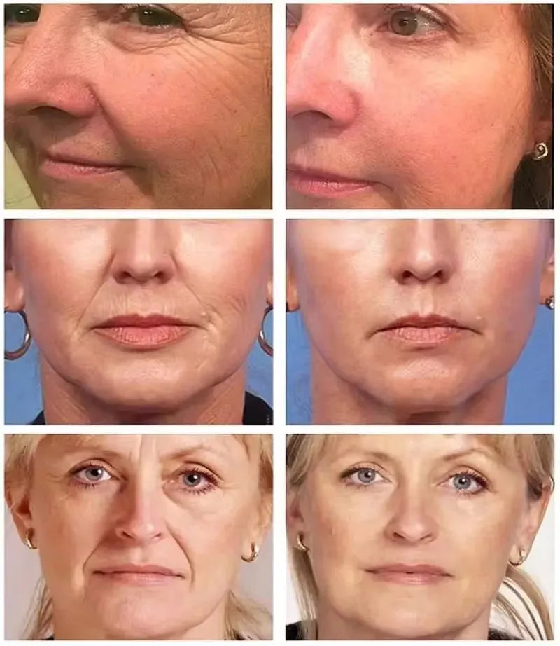 Instant Wrinkle Remover, Firming Facial Serum That Fades Fine Lines, Anti-Aging Essence, Whitens, Brightens, Nourishes Skin Care
