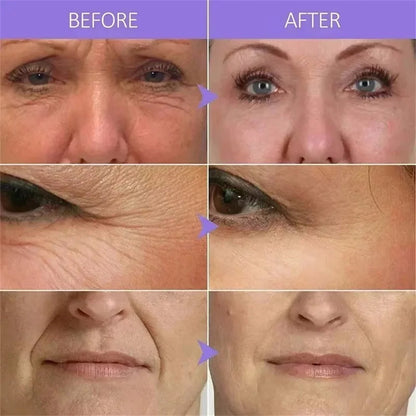 Instant Wrinkle Remover, Firming Facial Serum That Fades Fine Lines, Anti-Aging Essence, Whitens, Brightens, Nourishes Skin Care